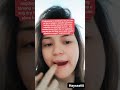 Dry lips 👄#viralnow #trendingvideo #trendingshorts