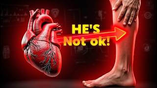 7 signs in your body that your HEART gives before it DIES