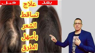 علاج تساقط الشعر. ايقاف تساقط الشعر ونموه مره اخرى