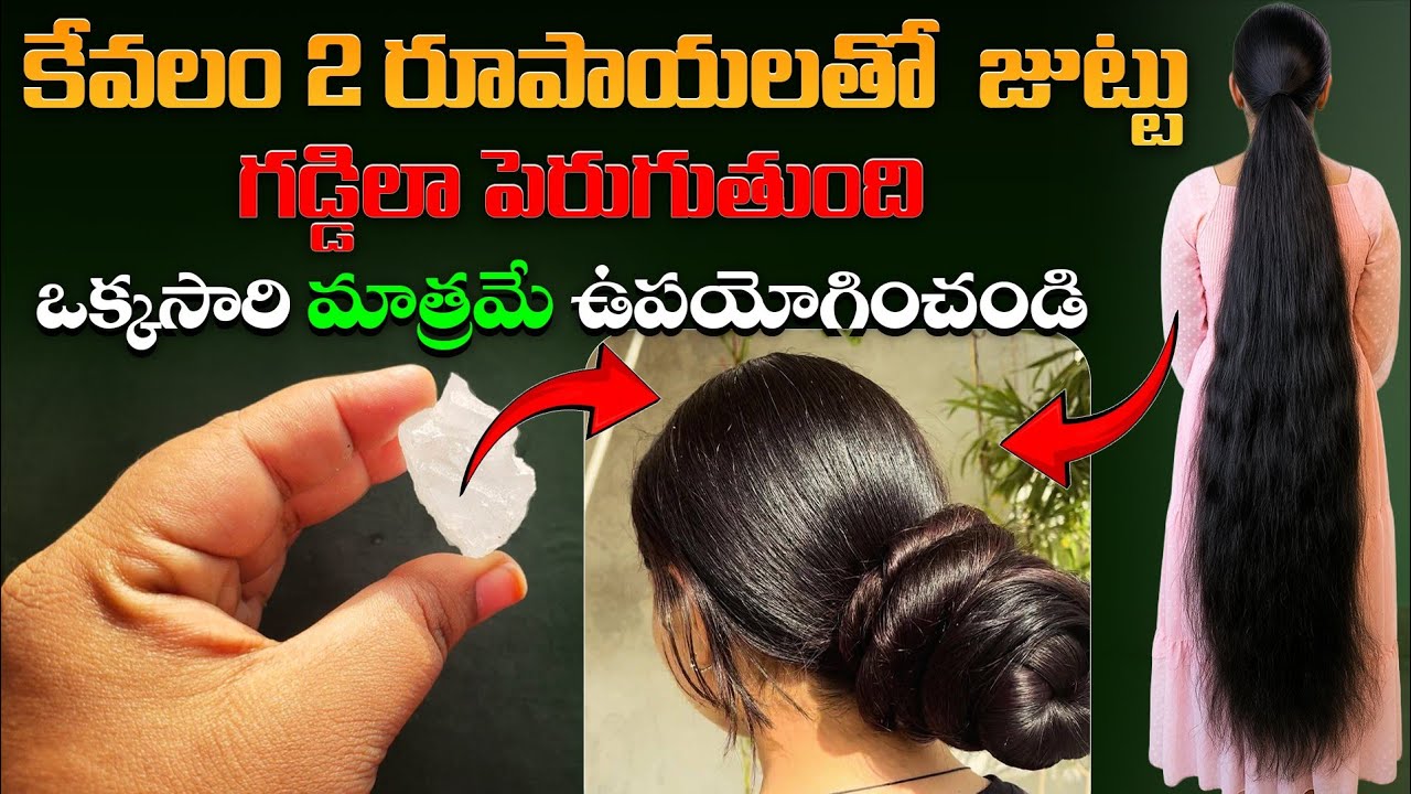 కేవలం 2రూ.తో  జుట్టుగడ్డిలా పెరుగుతుంది ఒక్కసారి మాత్రమే ఉపయోగించండి | Best Remedies For Hair Growth