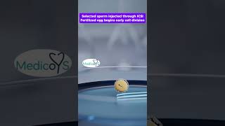 How Does Ivf Work? Complete Ivf Process In 3D Medical Animation