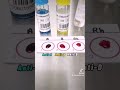 Blood typing or blood grouping step by step laboratory medtech medtechstudent mls mt bloodbank