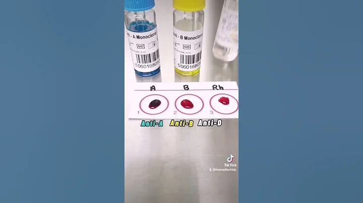 Blood typing Or Blood grouping step by step #laboratory #medtech #medtechstudent #mls #mt #bloodbank - DayDayNews