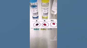 Blood Typing Or Blood Grouping Step By Step Laboratory Medtech Medtechstudent Mls Mt Bloodbank 