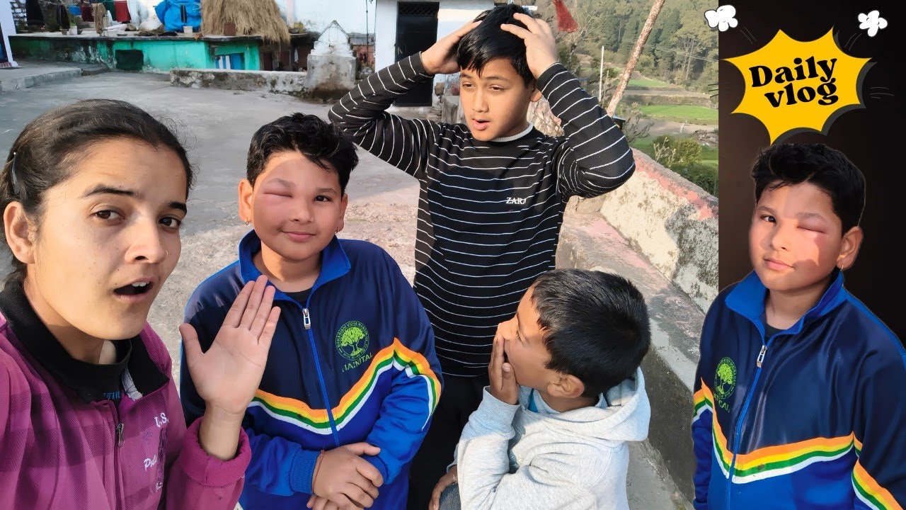 Om ke face mein ye kya ho gaya😱