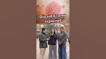 Doctor explains Discoid Eczema #shorts