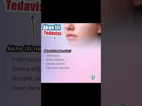 Akne İzi Tedavisi