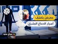 معرض في باريس يكشف عما يدور في دماغ الإنسان 