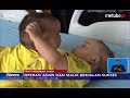 Beginilah Kondisi Kesehatan Bayi Kembar Siam Adam & Malik usai Operasi Pemisahan - iNews Siang 14/08