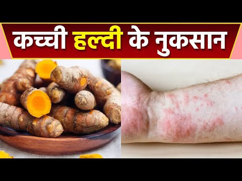 Kachi Haldi Ke Side Effects