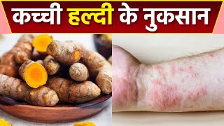 कच्ची हल्दी खाने के है ये गंभीर नुकसान । Kachi Haldi Khane Ke Nuksan । Boldsky *Health screenshot 5