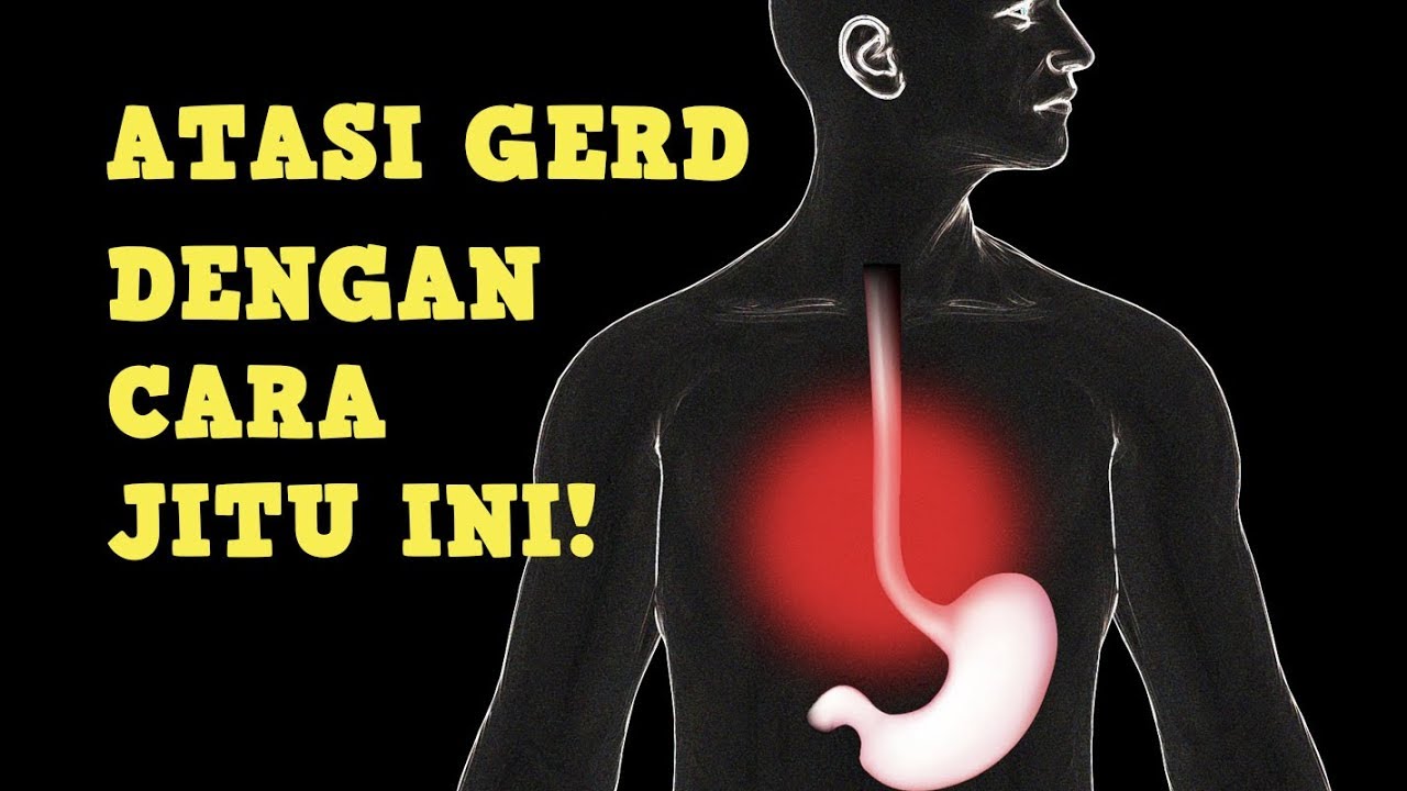 cara jitu mengatasi gerd 