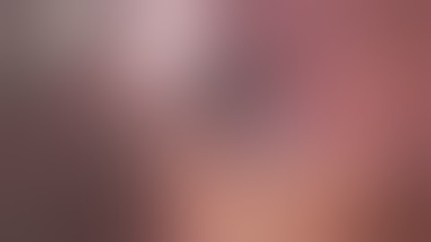 Lap Gastric GIST Surgery