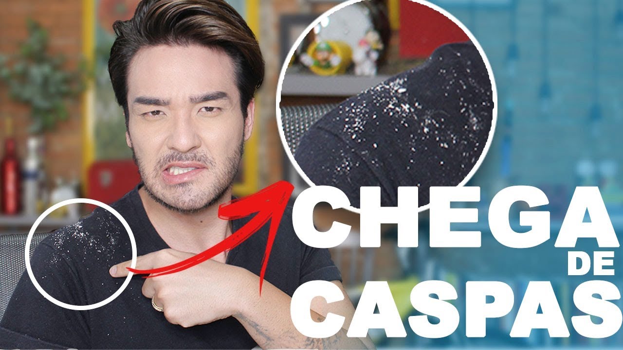 7 DICAS INFALÍVEIS PARA ELIMINAR/PREVINIR A CASPA!