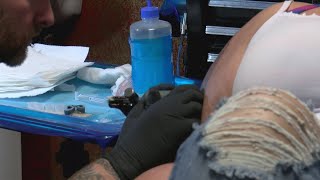 A Colorful Alternative To Mastectomy Surgery