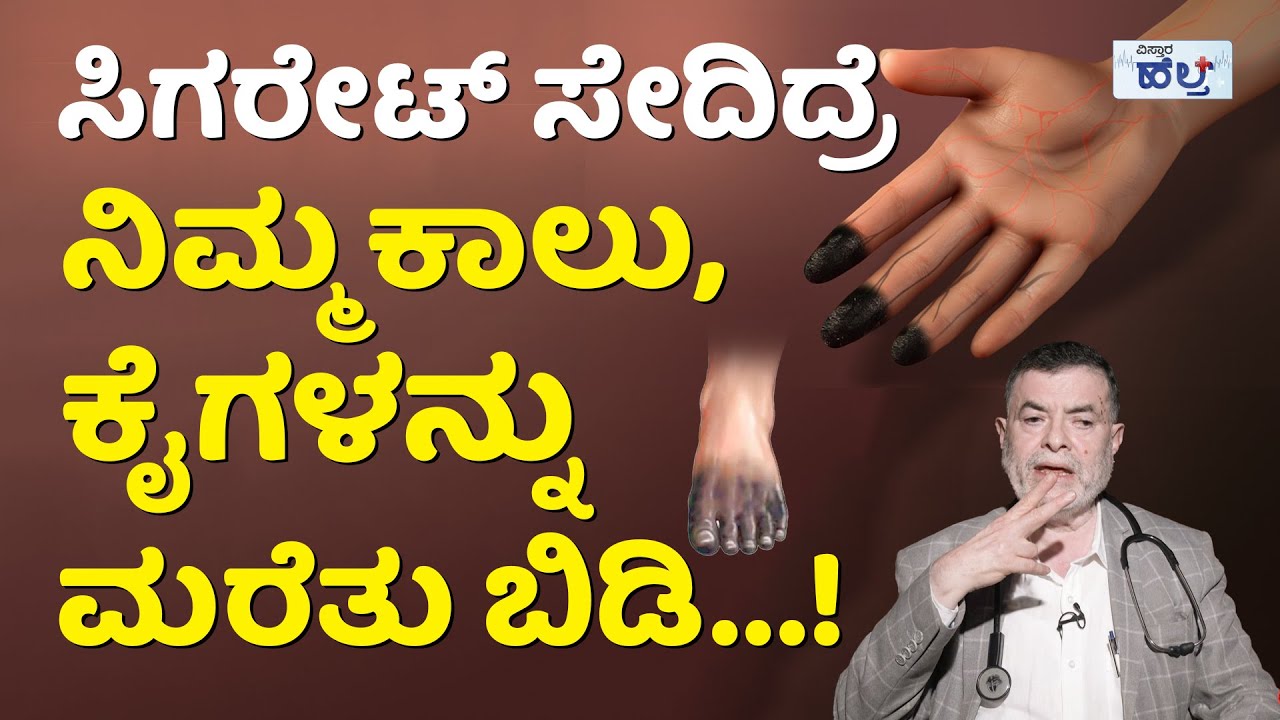 ಹೊಗೆಯಿಂದ ಕಾಲು, ಕೈಗಳನ್ನು ಹೊಗೆ ಹಾಕಿಸಿಕೊಳ್ಬೇಕಾ? | Hidden Danger: How Smoking Triggers Buerger's Disease