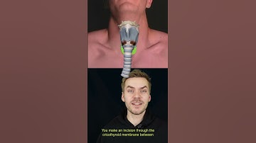 Anatomy of cricothyrotomy (emergency airways)
