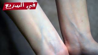 ليه العروق لونها أخضر مع إن جواها دم أحمر؟ | في السريع