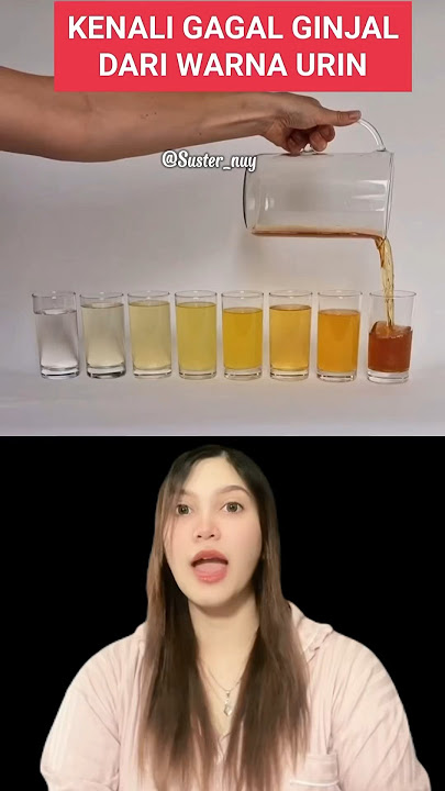 THIS URINE COLOR IS A SIGN OF KIDNEY FAILURE⁉️#education #healtheducation #urine #kidneyfailure #...