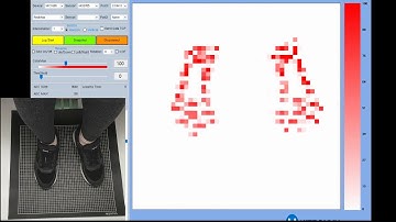 Foot pressure mapping and gait measurement with MC1600