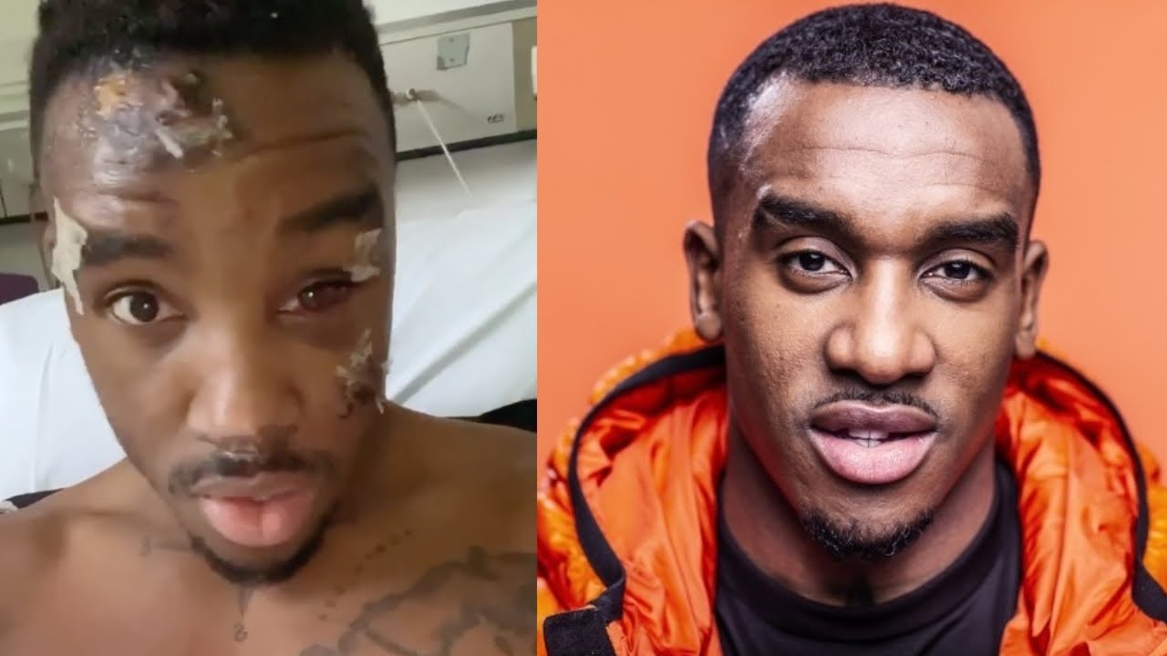 Bugzy Malone lucky to be alive as he reveals crash injuries from