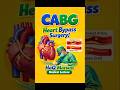 CABG Explained in 60 Seconds | Heart Bypass Surgery 💓
