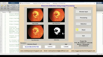 Glaucoma Detection Using Image Processing Matlab Project Source Code