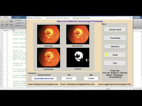 Glaucoma Detection Using Image Processing Matlab Project Source Code