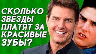 Сколько знаменитости платят за красивые зубы Сколько знаменитости платят за красивые зубы