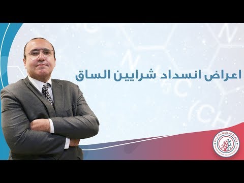 اعراض انسداد شرايين القدم ومتى يجب عمل توسيع لشرايين الساق | دكتور وليد الدالي