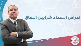 اعراض انسداد شرايين القدم ومتى يجب عمل توسيع لشرايين الساق | دكتور وليد الدالي