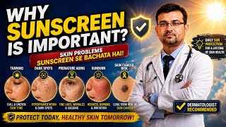 If You Don’t Wear Sunscreen, You Must Watch This Video! Why is sunscreen important? Dr. Animesh MCh screenshot 2