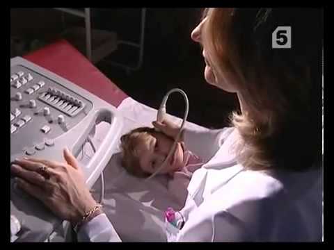 УЗИ головного мозга для детей и взрослых.