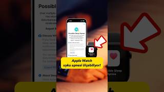 Apple Watcha Uyku Apnesi Tespit Özelliği Geldi