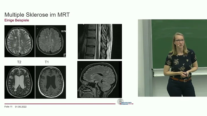 Patient*innenver...  Multiple Sklerose 2022 | MS i...