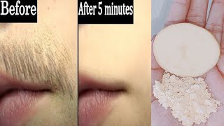 Permanent hair removal at home naturally | How to remove facial hair | Hair removal at home