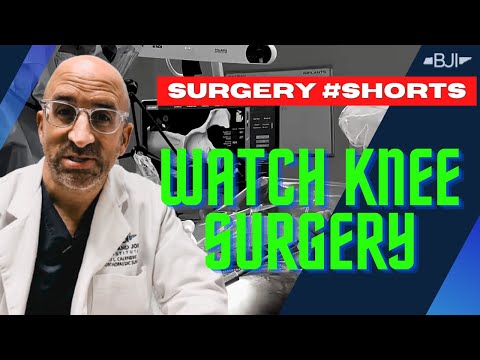 Watch Knee Surgery: Tibia Rotation in Knee Replacement Surgery #OrthopedicSurgery #surgeryshorts