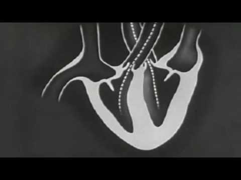 Autoheart - Lent (Bright Light Bright Light Remix)