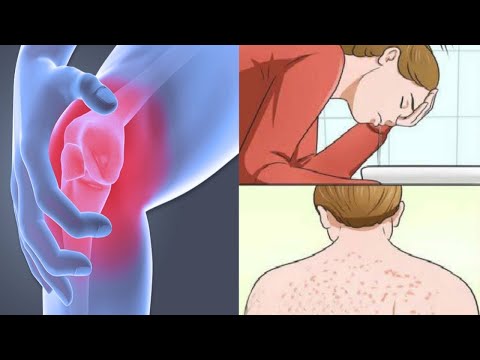Signs of Mold Illness And How to Tell If you are at Risk!