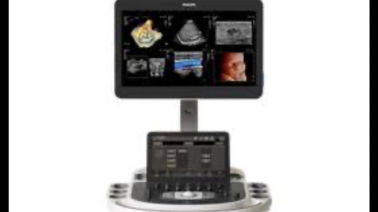 Philips AFFINITI 30 50 70 epiq. Comandos básicos e dicas 04 - YouTube