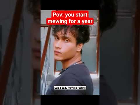 1 year mewing transformation 🫢