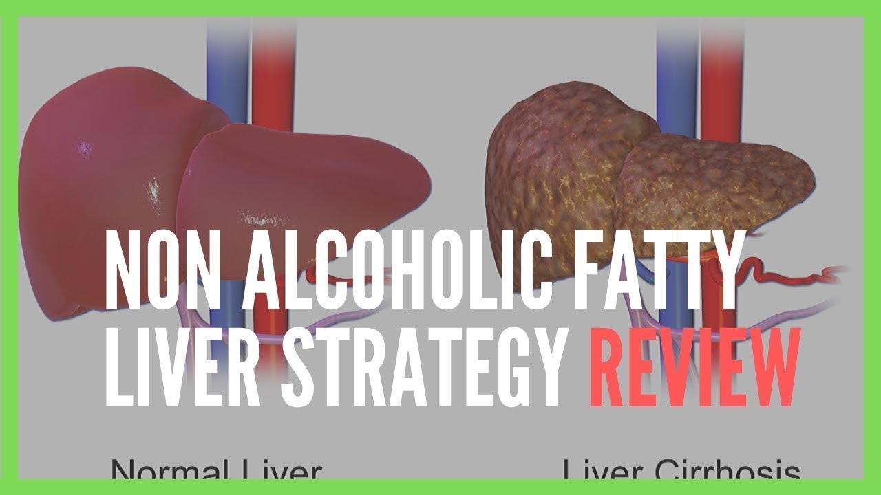 Non Alcoholic Fatty Liver Strategy Reviews || Non Alcoholic Fatty Liver ...