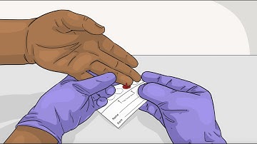 How to collect a dried blood spot sample