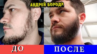 видео: Сделал бороду ГУЩЕ за 100 дней / Это помогло мне увеличить плотность бороды/ВЫПУСК №3/ Андрей Борода картинка: Сделал бороду ГУЩЕ за 100 дней / Это помогло мне увеличить плотность бороды/ВЫПУСК №3/ Андрей Борода