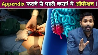 Appendix फटने से पहले कराएं ये ऑपरेशन | जानिए Symptoms और Treatment.!