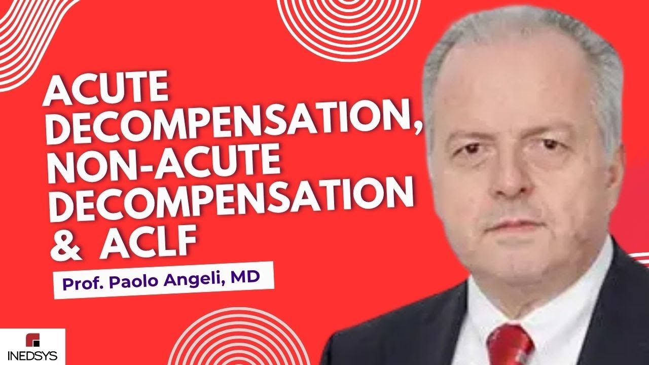 Acute Decompensation, Non-Acute Decompensation, and ACLF in Patients with Cirrhosis Dr. Paolo Angeli