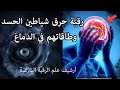 رقية حرق شياطين الحسد وطاقاتهم في الدماغ التي تسبب صداع وآلام دائما 