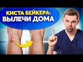 Главные ПРАВИЛА лечения боли под коленом. Избавься от кисты Бейкера НАВСЕГДА!