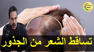 أقوى وصفة لعلاج تساقط الشعر من الجذور   -  الدكتور جمال الصقلي  -