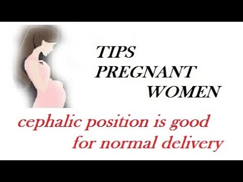 is cephalic presentation is good for normal delivery